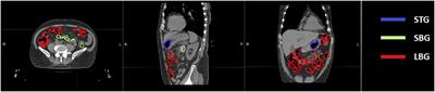 Why we should care about gas pockets in online adaptive MRgRT: a dosimetric evaluation